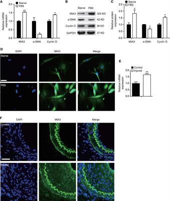 MIA SH3 Domain ER Export Factor 3 Deficiency Prevents Neointimal Formation by Restoring BAT-Like PVAT and Decreasing VSMC Proliferation and Migration